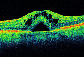 Used Opthalmic Equipment